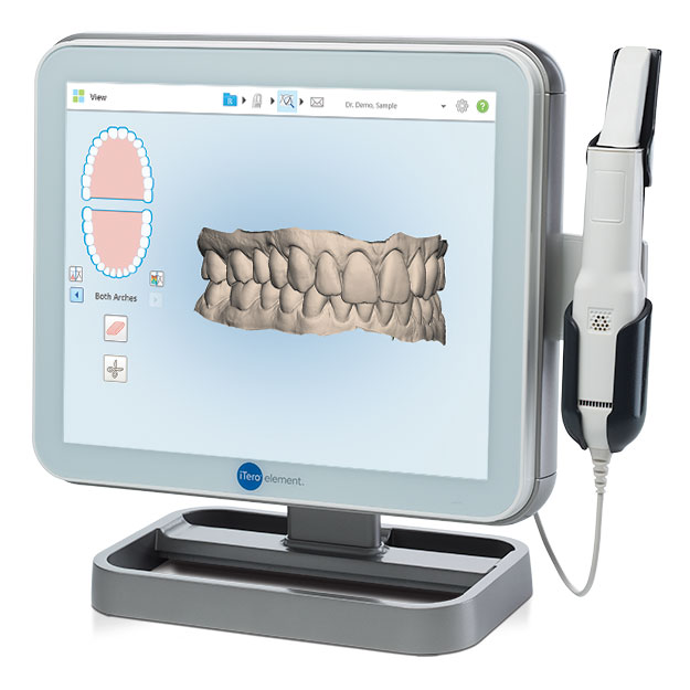 3D Itero Scan for Clear Invisalign Aligners at the Knightsbridge Clinic